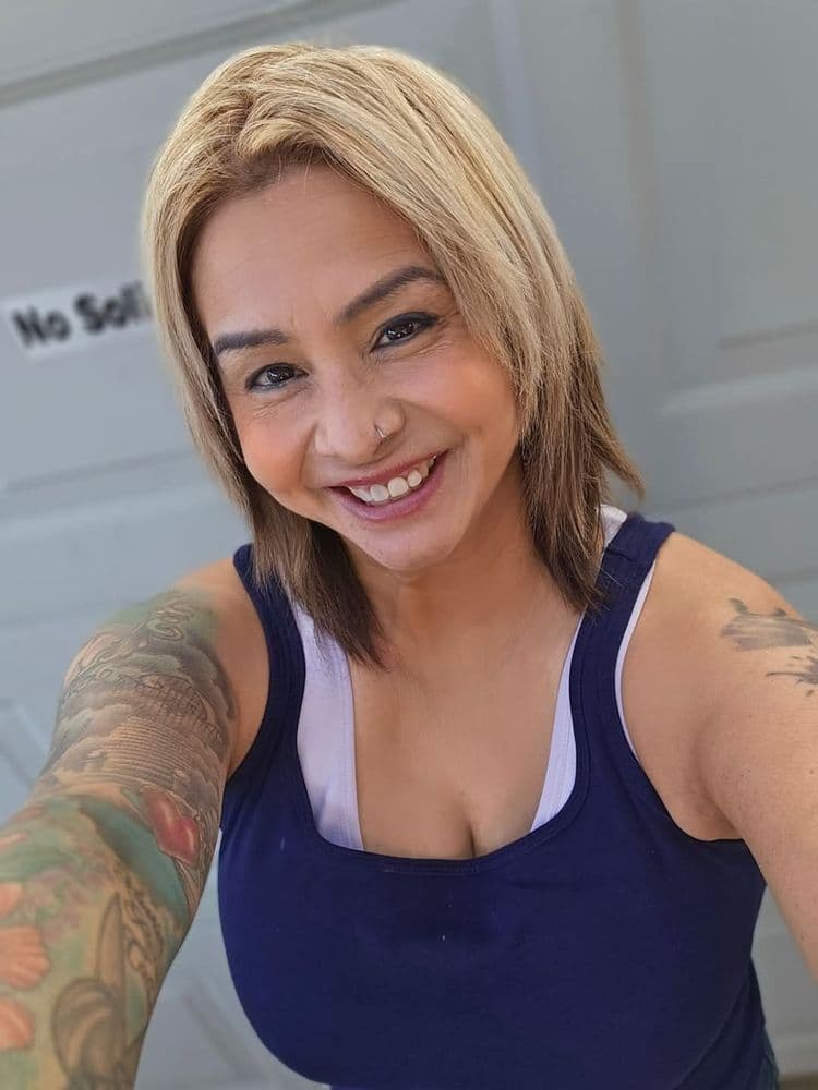 Willow Aesthetics - hair transplant in San Antonio, TX