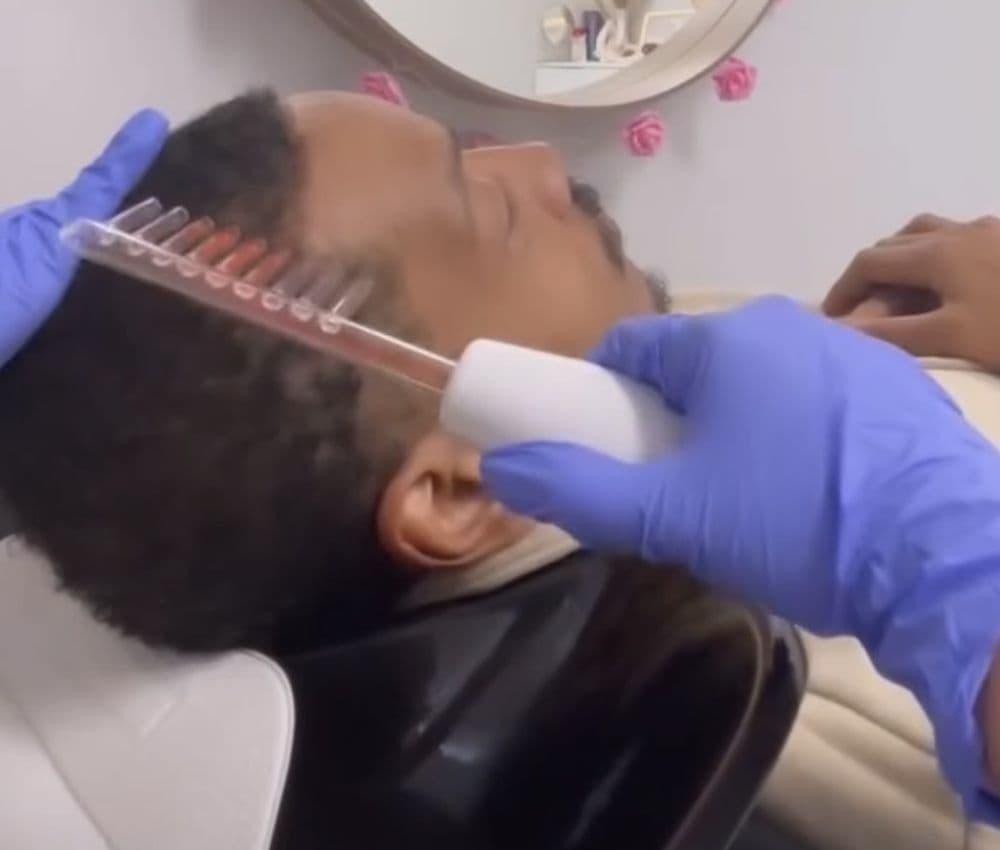 Calm Waters By Sofi - hair transplant in Laurel, MD