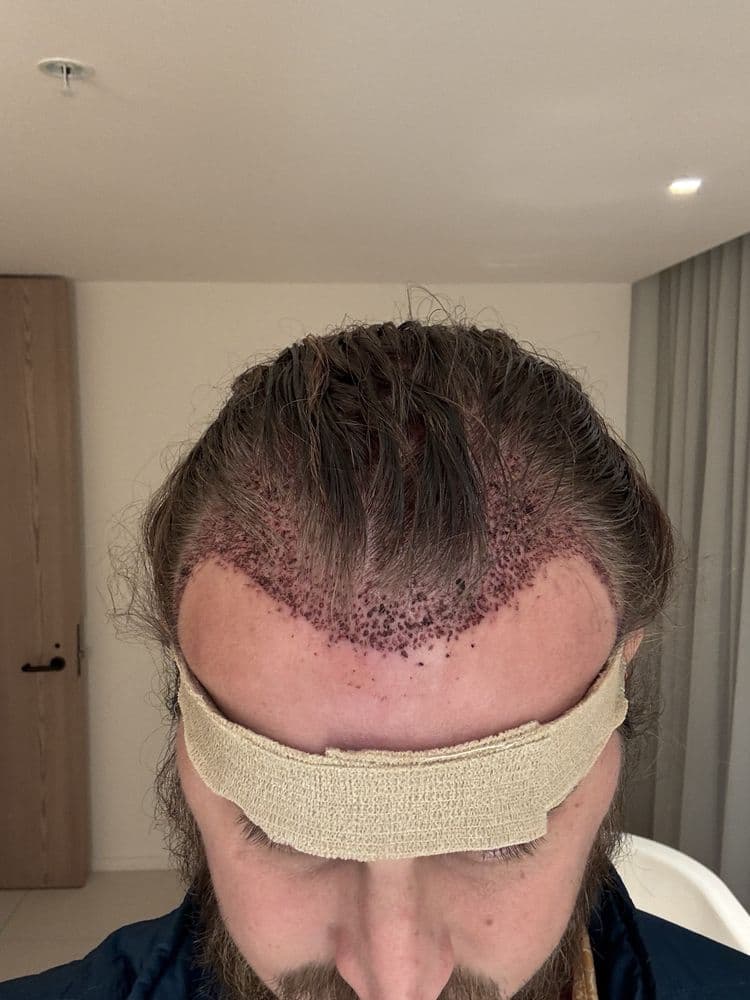 Abrams Aesthetics And Hair Restoration - hair transplant in Henderson, NV