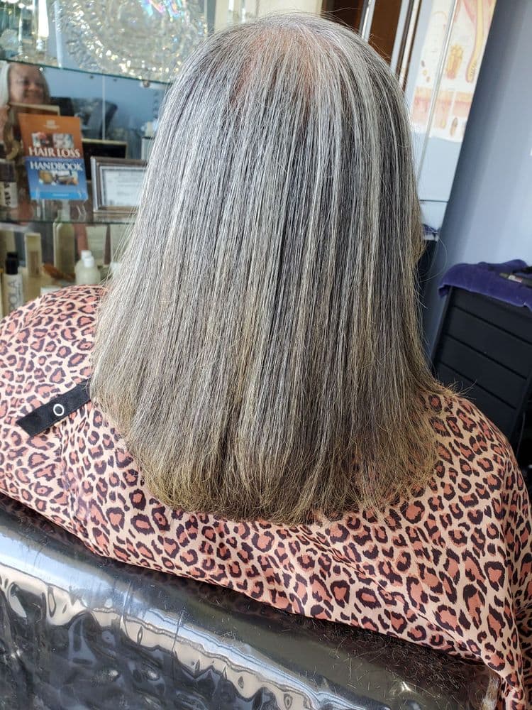 Frizzy To Fabulous - hair transplant in Chicago, IL