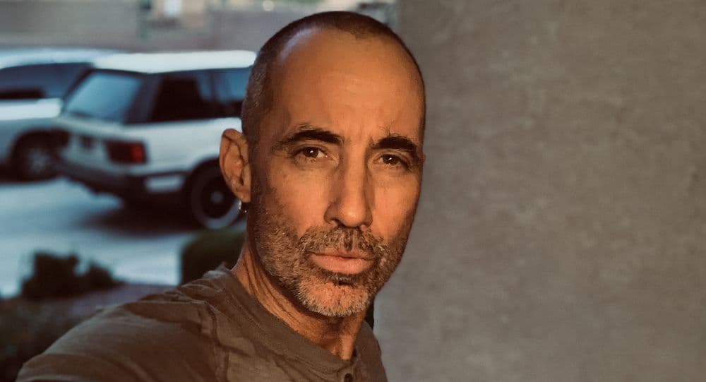 Alvi Armani - Beverly Hills - hair transplant in Beverly Hills, CA