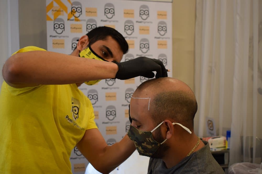 Pixel Pigments - hair transplant in Rockville, MD