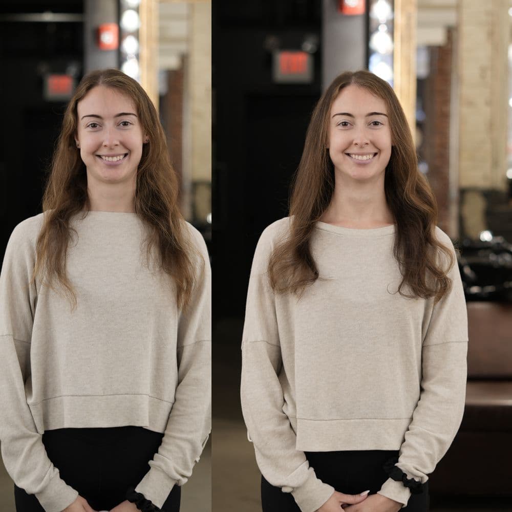 Parlour Hair Enhancements - hair transplant in Philadelphia, PA