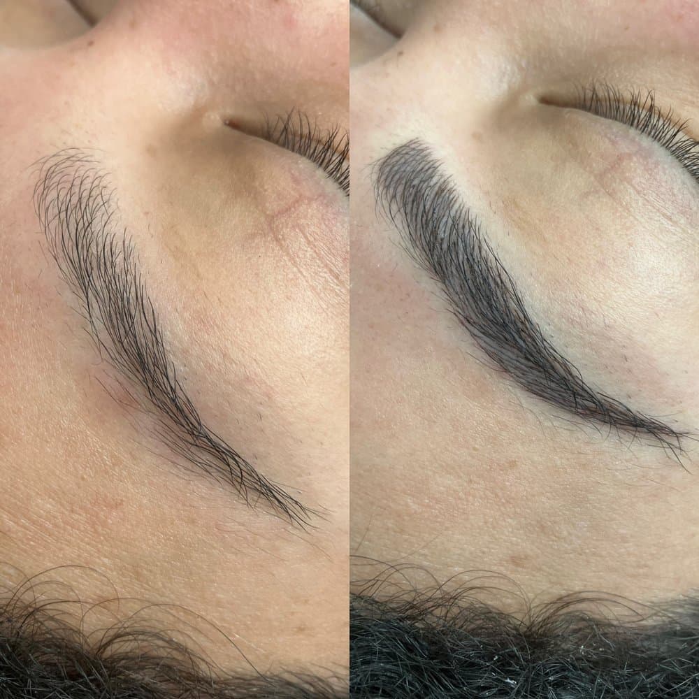 Professional Image and Laser Center - hair transplant in Charlotte, NC