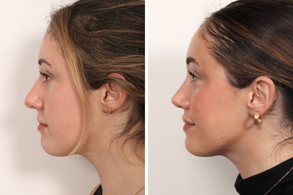 Benjamin Paul MD - hair transplant in New York, NY