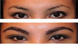Elite Hair Institute - hair transplant in ENCINO, CA