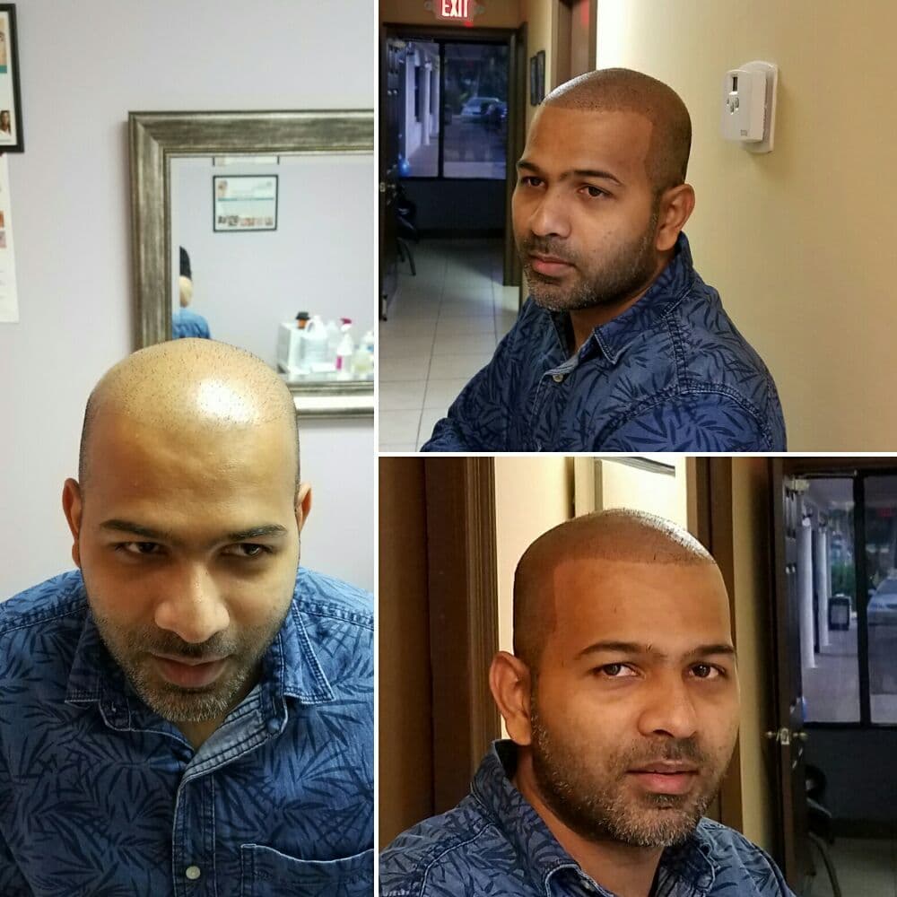 Machisimo Wellness Centers - hair transplant in Sunny Isles Beach, FL