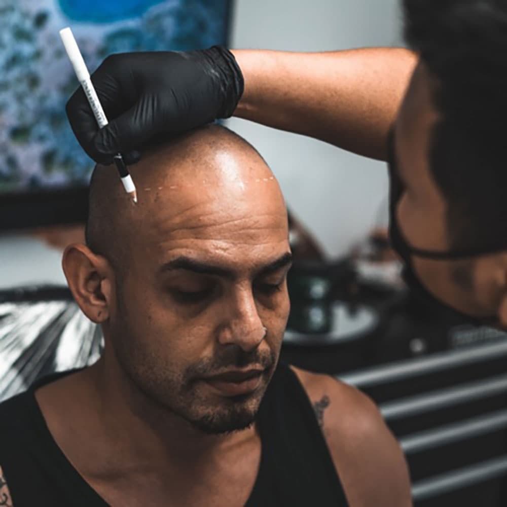 Revolution Scalp Micropigmentation - hair transplant in Springfield, IL