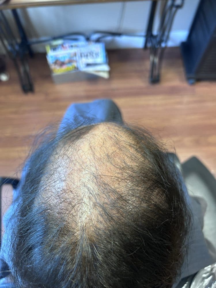 A Natural Image Hair Studio - hair transplant in Williamsville, NY