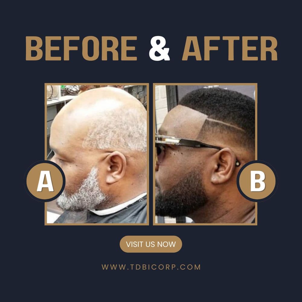 TDBI Hair Replacement Solutions - hair transplant in Las Vegas, NV