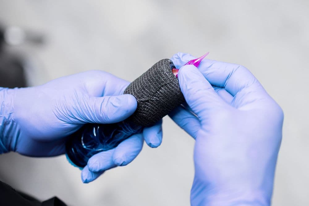 SMP Artistry - hair transplant in Norcross, GA