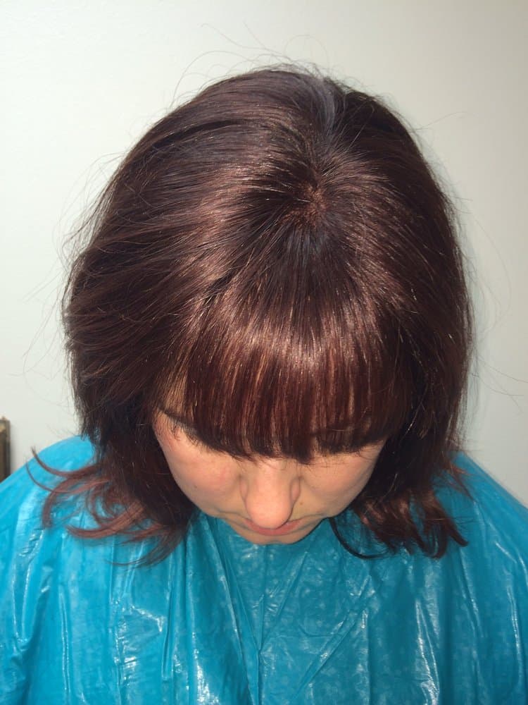 Shear Sadie - hair transplant in West Allis, WI