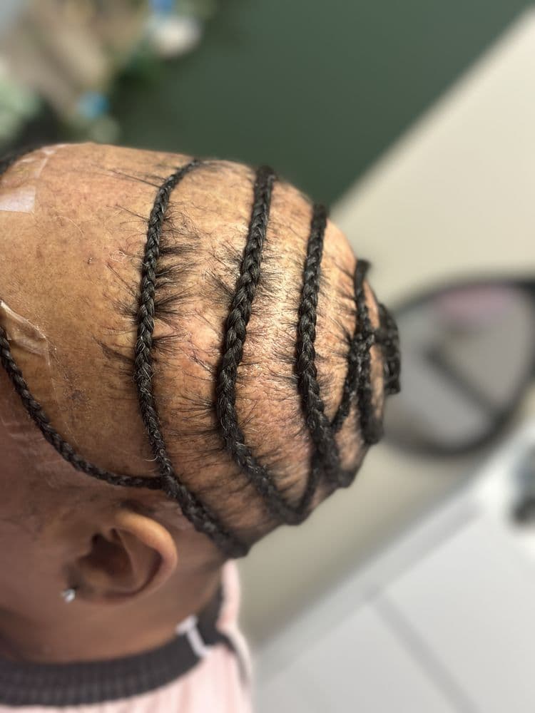 Faith’s Chosen Hair Repair - hair transplant in Tampa Bay, FL