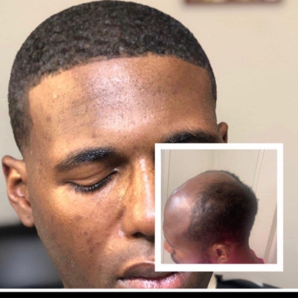 The Grooming Place - hair transplant in Tempe, AZ