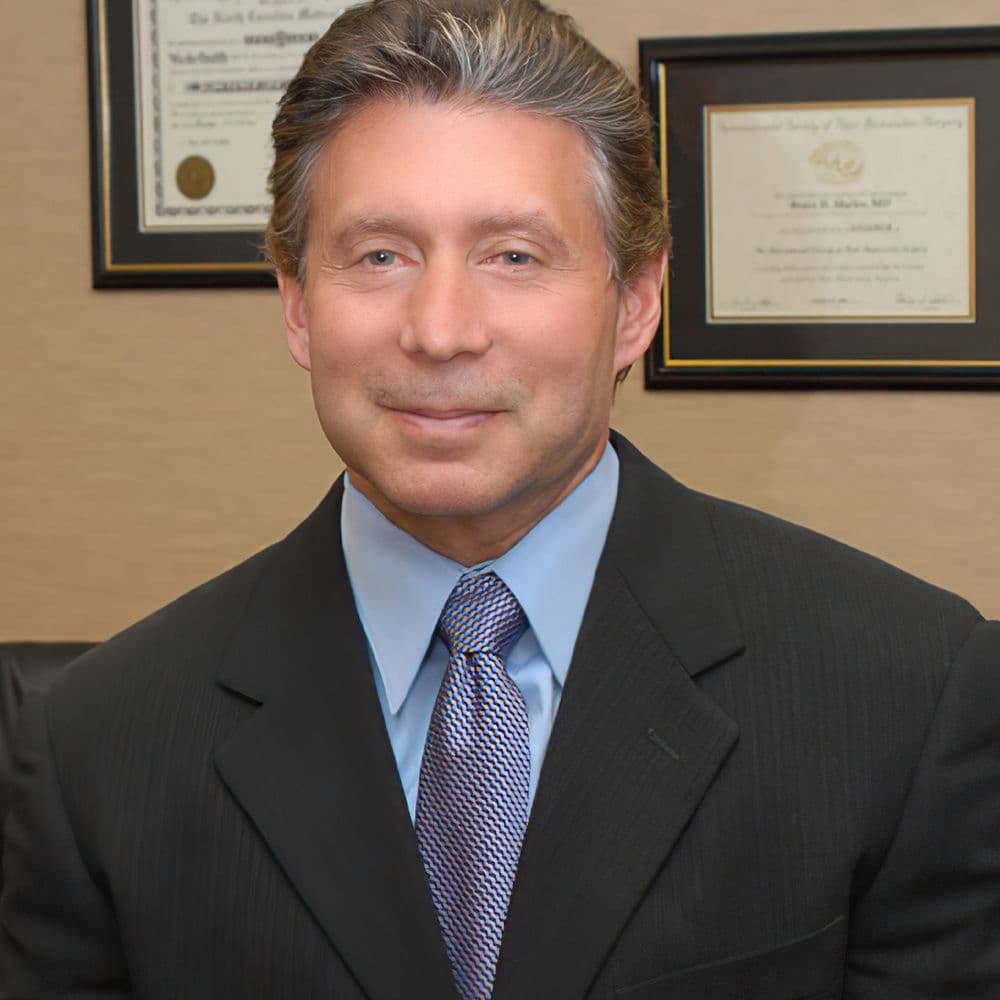 Restore Hair - hair transplant in Charlotte, NC