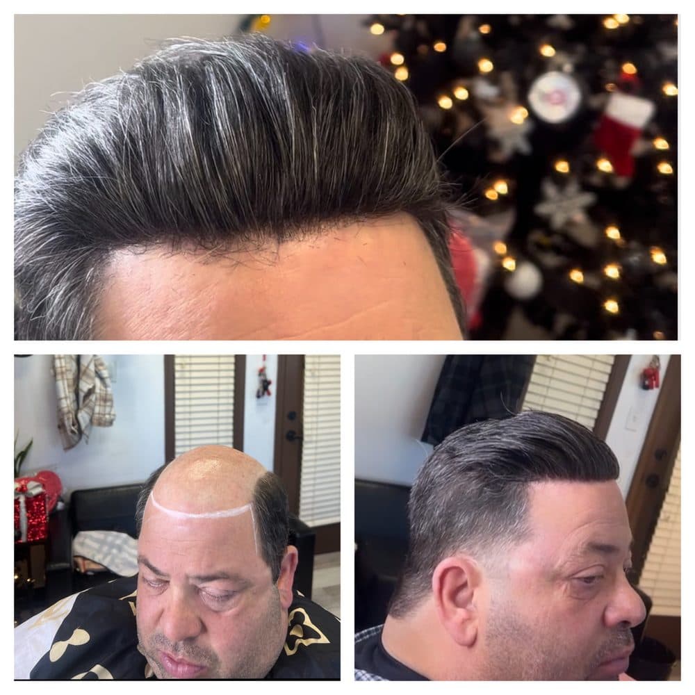BarberxRios - hair transplant in Peoria, AZ
