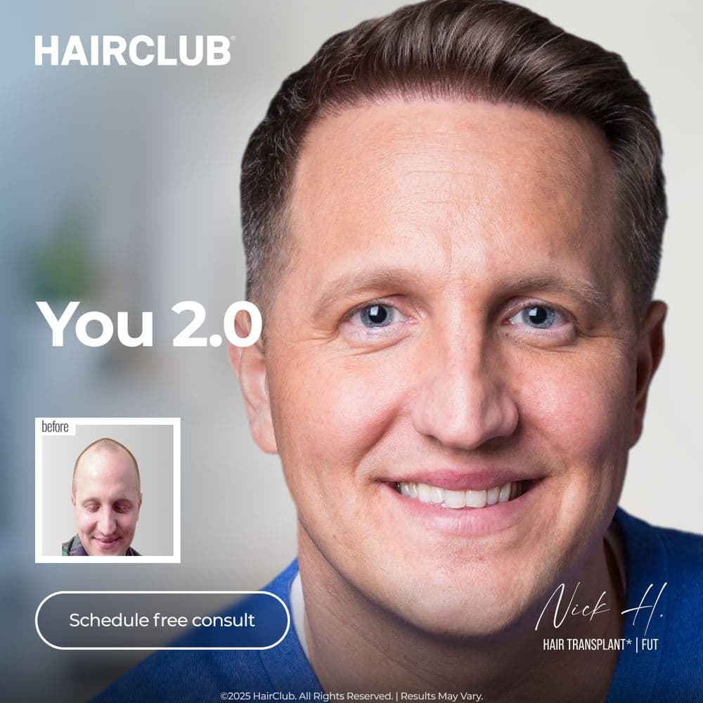 HAIRCLUB - hair transplant in Charlotte, NC