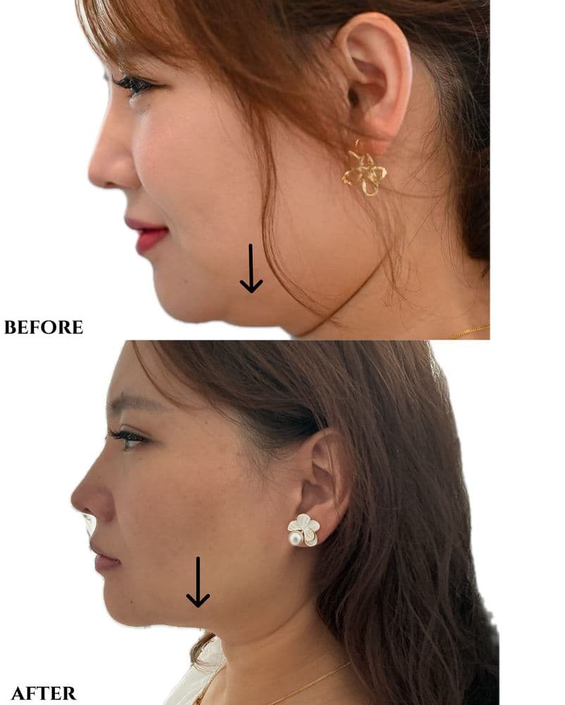 Linly Medspa and Wellness - hair transplant in Houston, TX