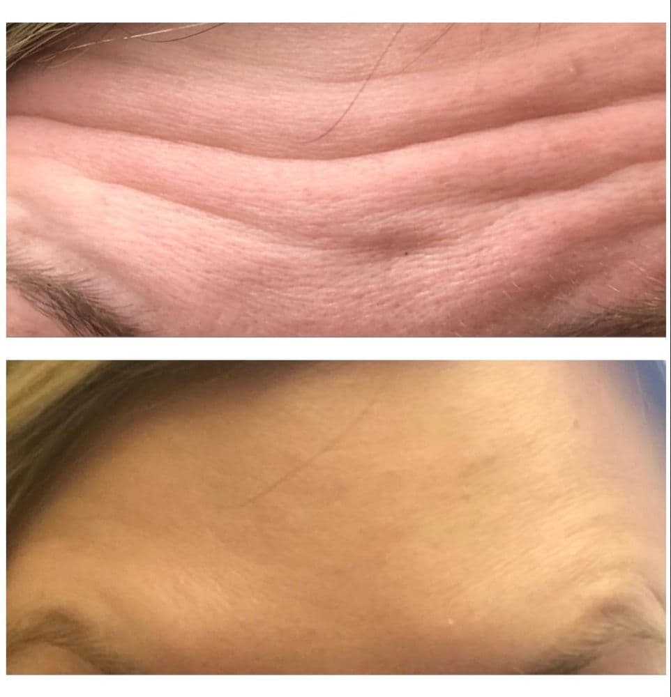 Oasis MedSpa - hair transplant in Madison, AL