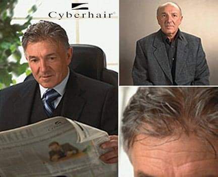 Jerry Barcroft - hair transplant in Arlington, TX