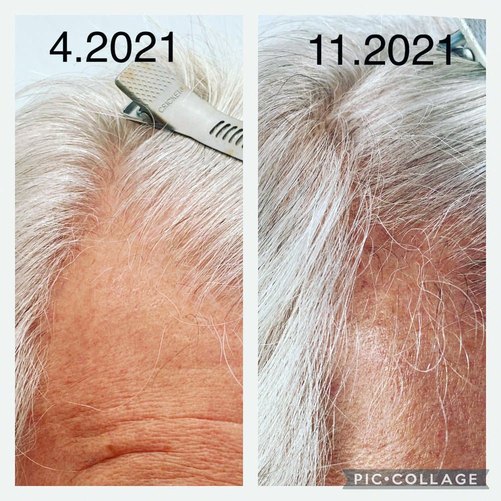 Evolve Scalp Health & Wellness - hair transplant in Tucson, AZ