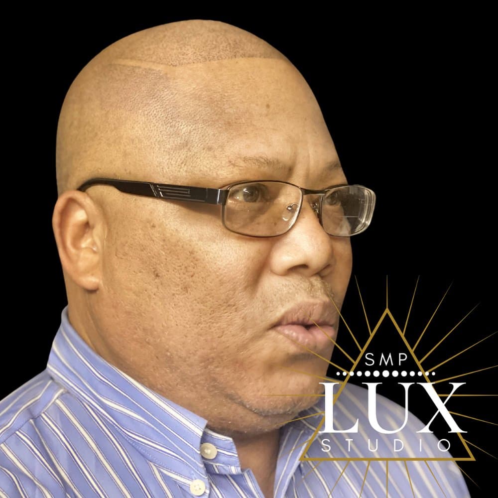 Lux SMP Studio - hair transplant in San Diego, CA