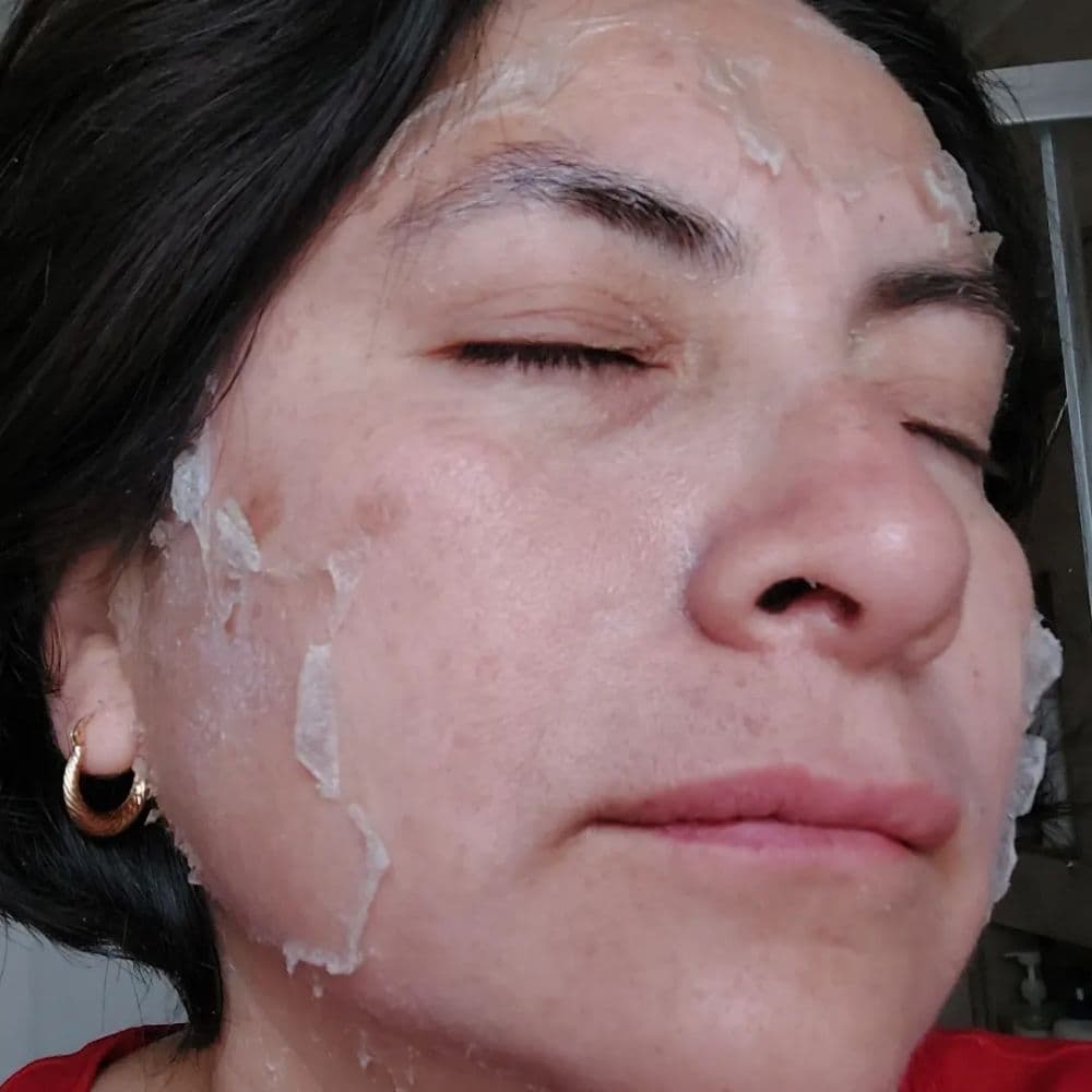 Renewed Health and Wellness - hair transplant in Prospect, CT