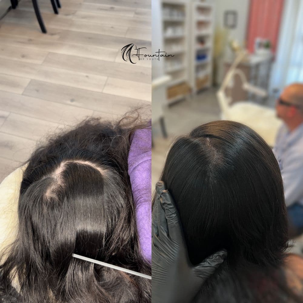 Fountain Of Youth - hair transplant in Roseville, CA