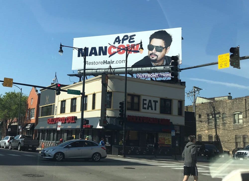 RESTORE by Katona - hair transplant in Deerfield, IL