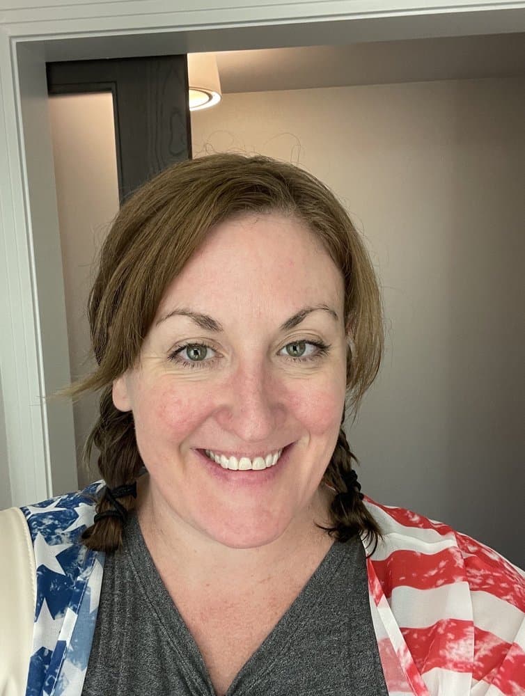 NWME Aesthetics - hair transplant in Carrollton, TX