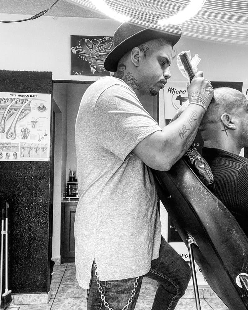 Micro Pig SMP - hair transplant in Orlando, FL