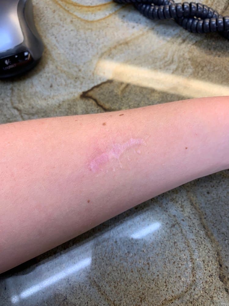 Dermatology Associates - hair transplant in Birmingham, MI