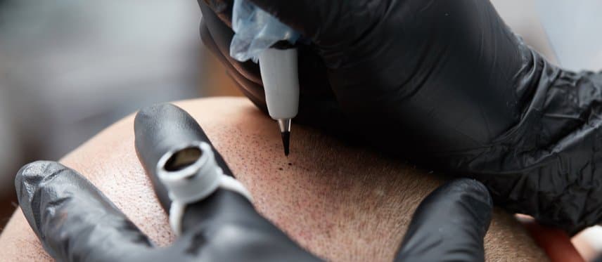 Dallas Scalp Associates - hair transplant in Richardson, TX