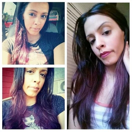 Jami Hayes - hair transplant in Beaverton, OR