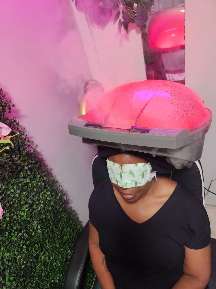 Ephraim - hair transplant in North Little Rock, AR