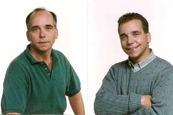 Mane Solution - hair transplant in Albany, NY
