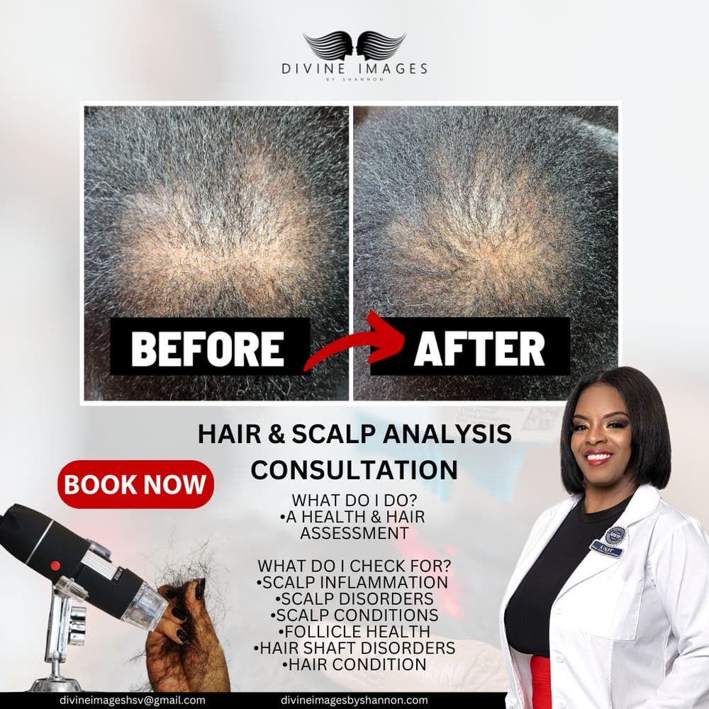 Divine Images by Shannon - hair transplant in Madison, AL