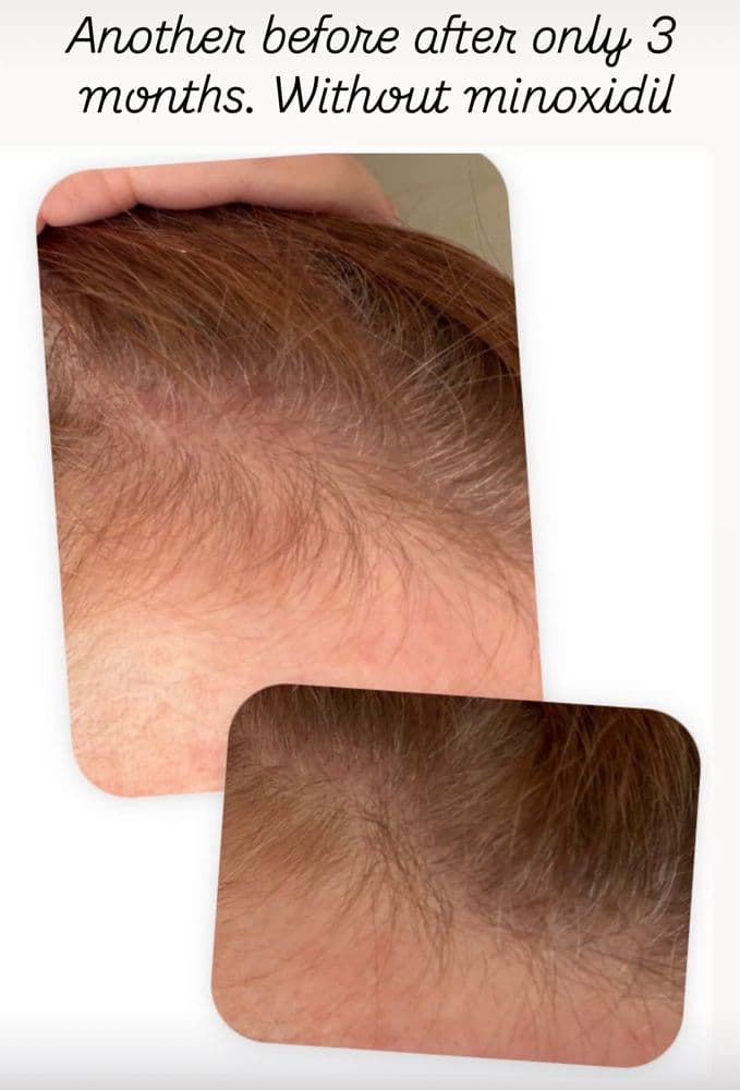 HairVive Trichology Clinic - hair transplant in Los Altos, CA