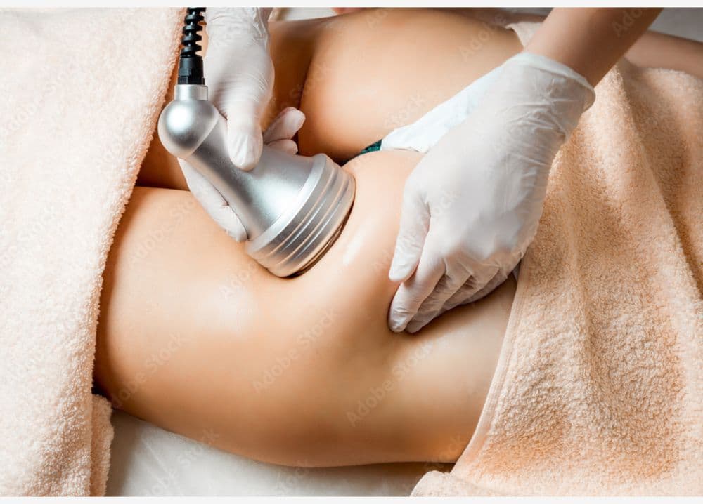 Contour Me Diva - hair transplant in Sacramento, CA