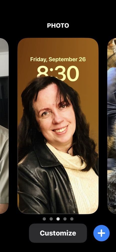 B. Beautiful - hair transplant in Coralville, IA