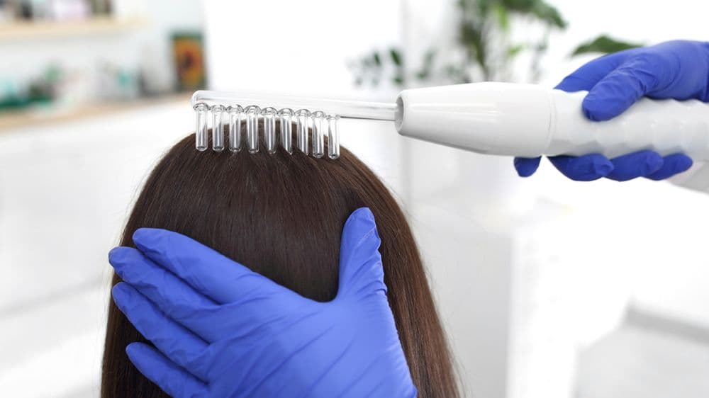 Interchangeable Crowns - hair transplant in Charlotte, NC