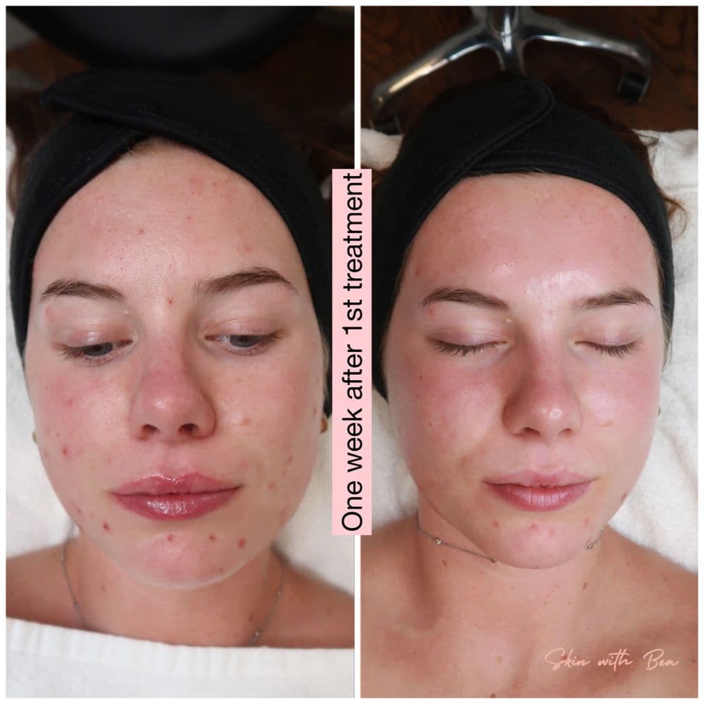 Skin With Bea Esthetics - hair transplant in Scottsdale, AZ