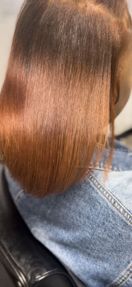 Root Regain - hair transplant in Southfield, MI