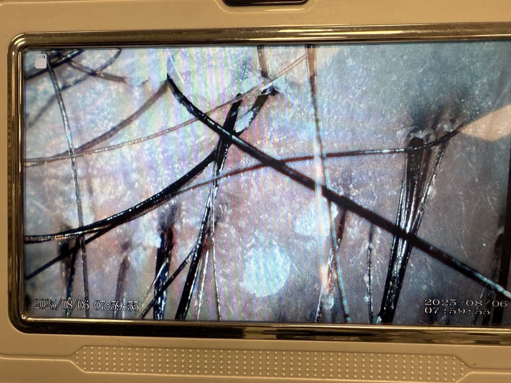 Empower Beauty - hair transplant in Beverly, MA