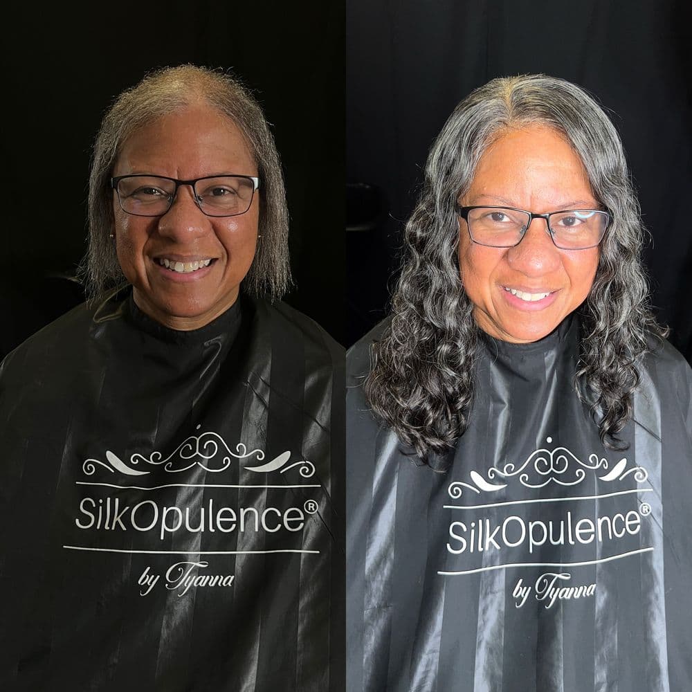 Silkopulence - hair transplant in Philadelphia, PA