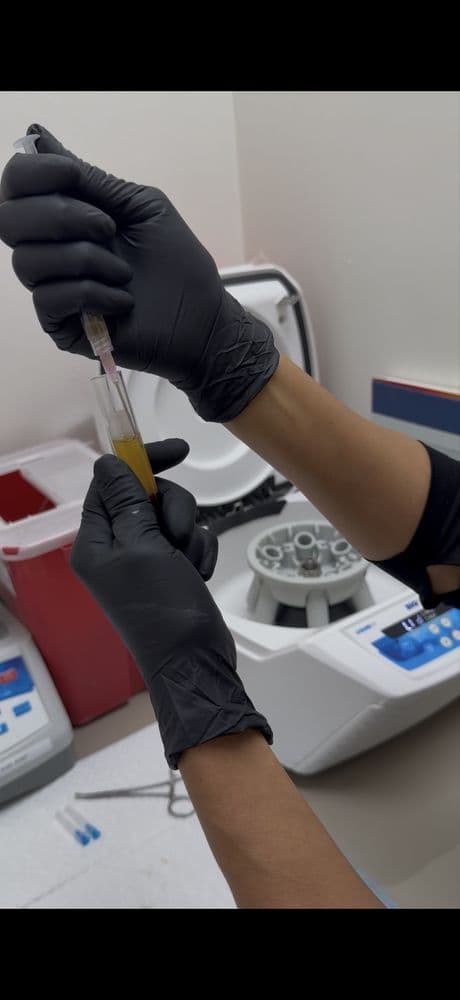 Ohm Med Spa - hair transplant in San Diego, CA