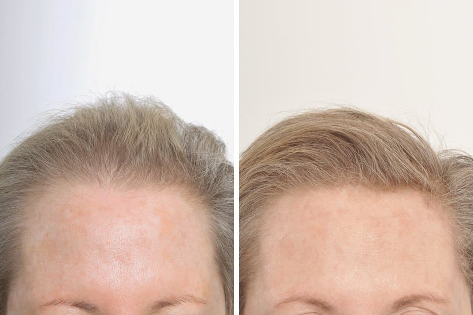 HairCareMD - hair transplant in New York, NY