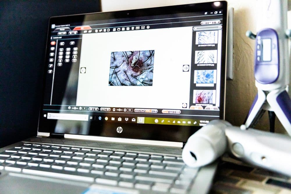 Hair Growth Clinic - hair transplant in Parker, CO