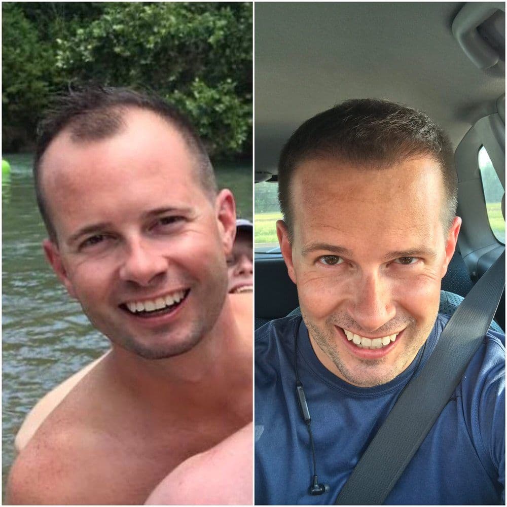 McGrath Medical - hair transplant in Houston, TX