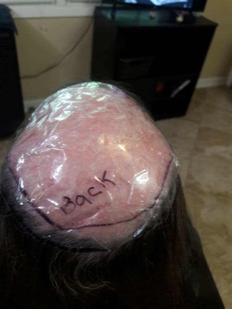 Hair Fantasy - hair transplant in Bowie, MD